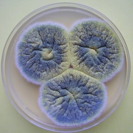 Bacteriën op voedsel